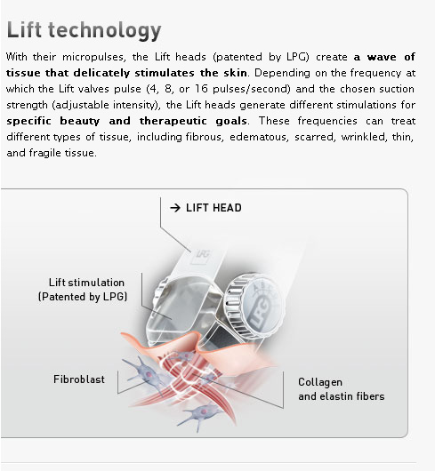 Endermologie Lift Technology Cleveland OH